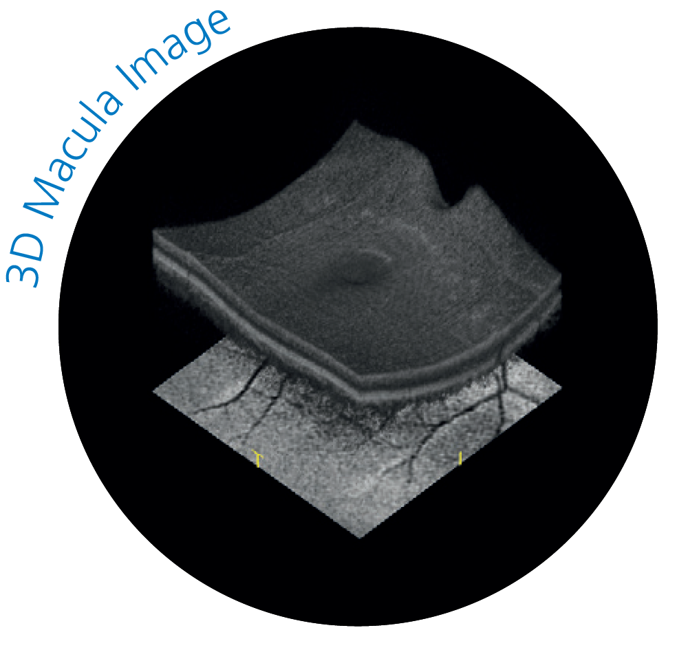 3D OCT scan of the macula showing retinal layers